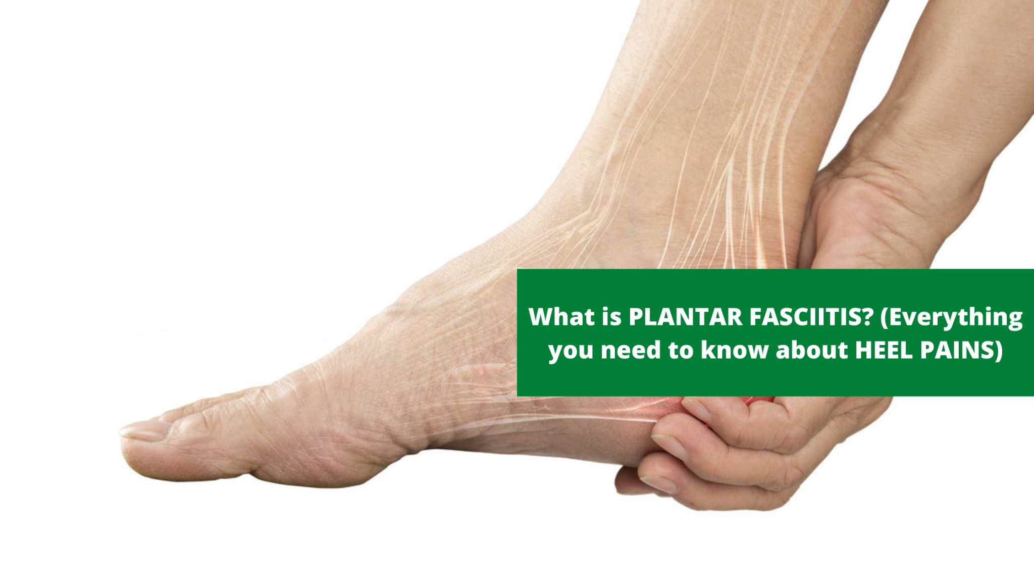 WHAT IS PLANTAR FASCIITIS? (EVERYTHING ABOUT HEEL PAINS) Don Kelly