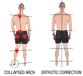 That Pain in Your Knees and Lower Back Could Be Linked to Your Feet and  Poor Foot Support!