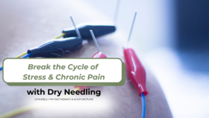 Relieve chronic pain and reduce stress with expert Dry Needling at Don Kelly Physiotherapy. Serving Limerick and Charleville. Click to learn how we help you find lasting relief.